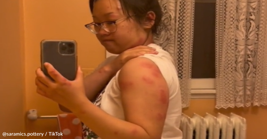 Woman Issues Warning After Finding Bed Bugs Hidden In AirBnb