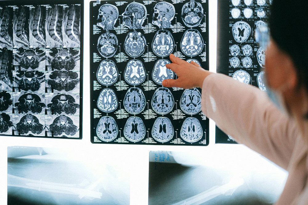 Scientists Uncover Early Clues To Why Alzheimer’s Attacks Memory First