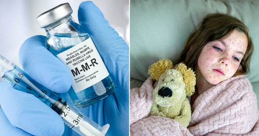 On the left, a gloved hand holds an MMR vaccine vial and syringe in a clinical setting; on the right, a sick child with a measles rash rests in bed.